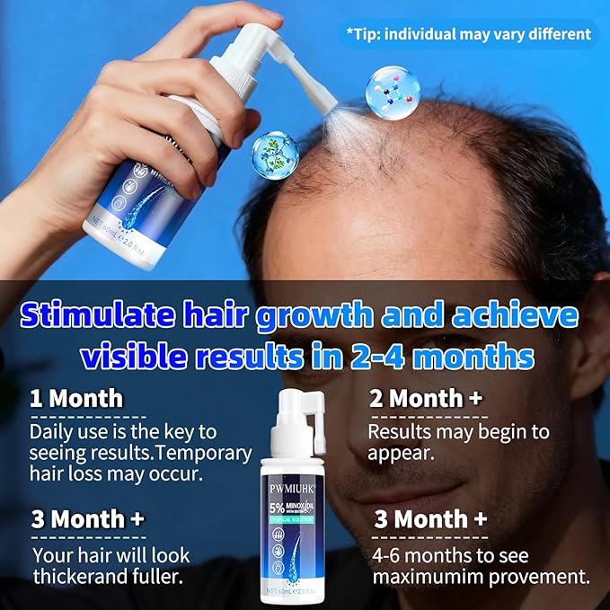 Minoxidil for Men and Women Hair Growth: 5% Minoxidil Spray Hair Regrowth Treatment Serum Stop Hair Thinning and Hair Loss For Stronger Thicker Longer Hair
