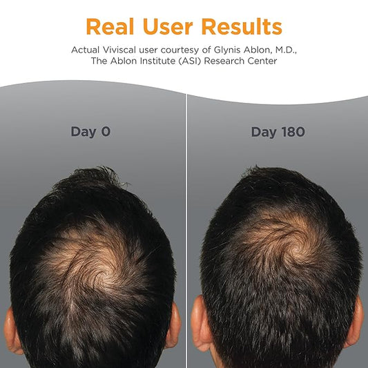 Viviscal Men's Hair Growth Supplements for Thicker Fuller Hair, Clinically Proven Collagen Complex, 60 Tablets 1 Month Supply