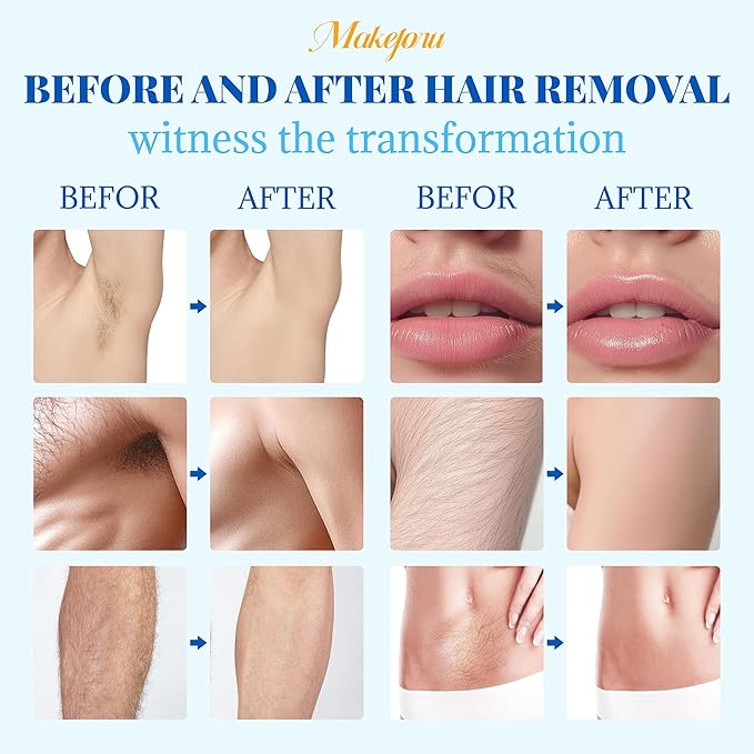 Hair Removal Wax Beads 2.2lb (1000g), Waxing for Whole Body, Painless Hair Removal Waxing for Women and Men, 10 Flavours, Contains 20 Wax Sticks