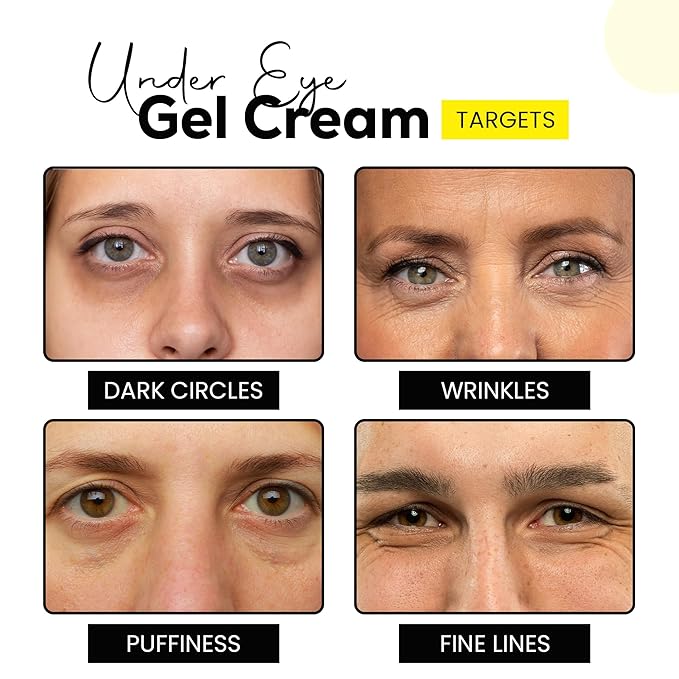 Under Eye Gel Cream with Retinol, Niacinamide, Caffeine, Vitamin C, & Aloe Vera Extract for Dark Circles, Fine Lines, and Puffy Eyes, For both Men & Women, 30ML
