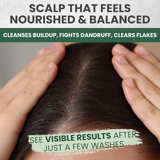 Tea Tree Lavender Shampoo & Conditioner Set with Mint & Rosemary, Cleanses, Cools & Soothes Dry, Itchy Scalp, Sulfate & Paraben-Free, For All Hair Types, 16 fl oz Each