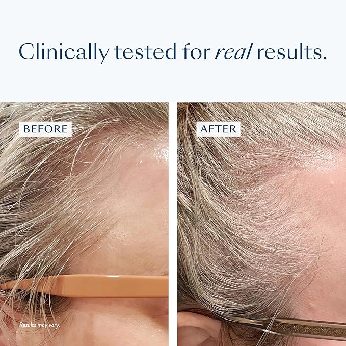 eSalon Hair Regrowth Essentials Bundle, 2% Minoxidil Treatment, Densifying Scalp Serum, Biotin Hair Multivitamins, One Month Supply