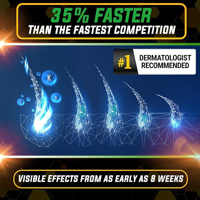 Elevate Hair Regrowth Treatment 5% Minoxidil Spray - Extra Strength Formula Professional Treatment for Hair Loss and Thinning for Regrowth - Stimulate Follicles for Men and Women 1 Month Supply