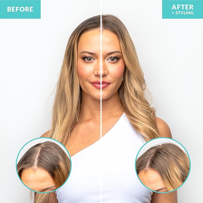 FoxyBae Dry Shampoo Powder - Non-Aerosol - with Biotin - for Dark, Brunette, Blonde, Colored Hair - Beach Whisper - 1.3 Oz with Spray Pump