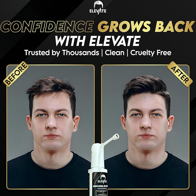 Elevate Hair Regrowth Treatment 5% Minoxidil Spray for Men - Clinically Proven Formula Fast Absorbing for Hair Loss and Growth Unscented Topical Hair Spray for Thinning & Balding Hair - Made in USA