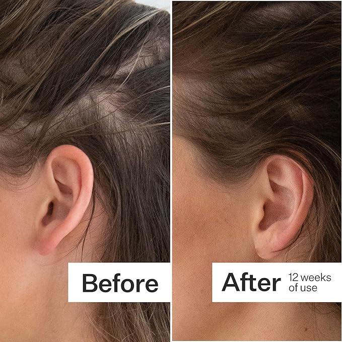 ACT+ ACRE Thick + Full Hair Capsules | Supplement for Thicker, Fuller Looking Hair | Bamboo, Horsetail, Biotin, Vitamin C | Strengthens Roots, Vegan, Gluten-Free, Mint Essenced | 60ct