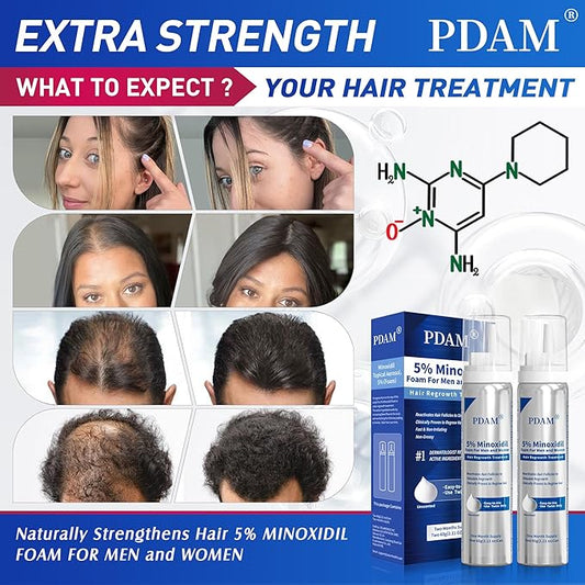 5% Minoxidil for Men and Women Foam Hair Growth - Minoxidil Foam Hair Regrowth Treatment for Men and Women, Topical Hair Loss Treatments, Extra Strength Thicker & Fuller Hair, 2 x 2.11 oz for 2 Months