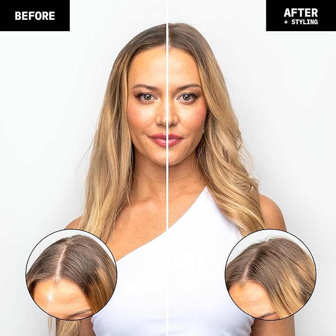 FoxyBae Overnight Dry Shampoo Spray for Hair - Absorbs Oil, Sweat, & Odor Overnight - Black Currant-Honey Scented - Sulfate-Free, Paraben-Free, Gluten-Free - Dream Refresh with Biotin - 7 Fl Oz