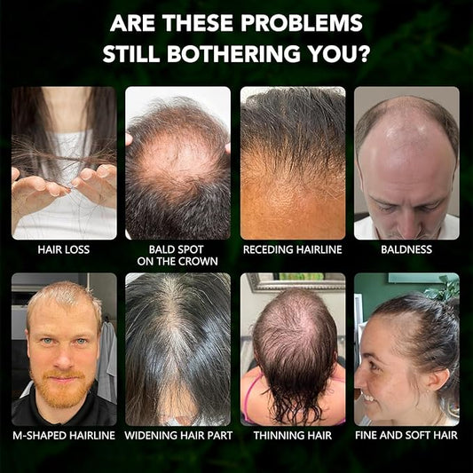 Minoxidil Spray Kit for Men and Women 5% Minoxidil Hair & Beard Growth Oil Kit, Advanced Hair Regrowth Serum Topical Solution Minoxidil Spray Treatment for Hair Loss, Thinning, Hair Thicker 2.02 fl.oz