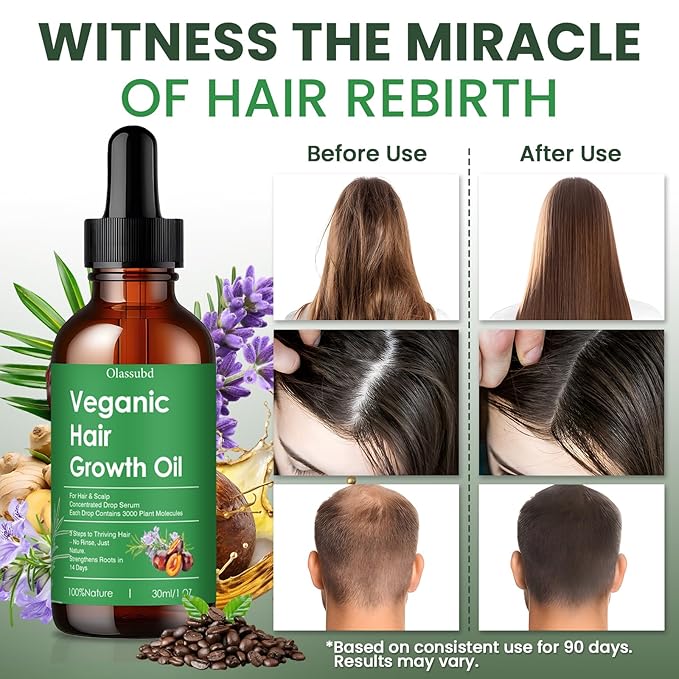 Hair Growth Oil with Rosemary Castor Oil Vegan Strengthening Formula for Thinning Hair Regrowth Treatment in Natural Vegan Hair Serum to Nourish Scalp Stimulate Follicles 3PCS for Man and Women