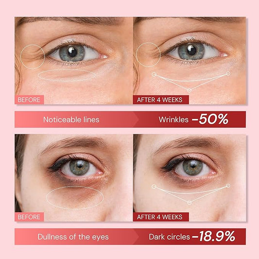 Retinol Anti Aging Eye Cream: Rapid Wrinkle Repair & Instant Under Eye Treatment - Reduce Dark Circles, Eye Bags, Puffiness for Women, Day & Night, 0.85 fl.oz