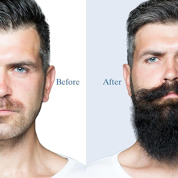 5% Minoxidil Foam for Men Hair and Beard Regrowth, Dermatologist-Recommended Lightweight Topical Solution, Thicker Fuller Hair Growth Treatment (60ml/2.11fl.oz), 4PCS