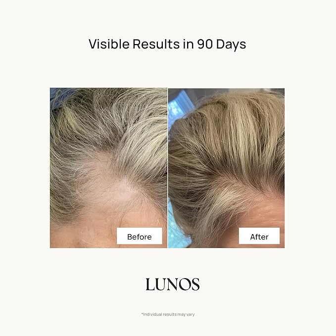 Lunos Grow Hair Growth Supplements - 17 Ingredient Formula with Biotin, Saw Palmetto, & Marine Collagen for Thicker, Fuller Hair - Hair Growth Vitamins for Women & Men