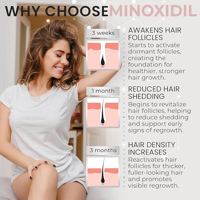 Minoxidil for Women | 5% Minoxidil For Women Hair Growth | Hair Regrowth Treatment | Unscented Topical Foam | Dermatologist Recommended | Clinically Proven Formula | 3 Month Supply