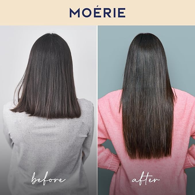 Moerie Shampoo and Conditioner Plus Hair Mask and Spray Mega Pack – The Ultimate Growth Care – For Longer, Thicker, Fuller Hair - Volumizing Products – Paraben & Silicone Free (Set of 6)