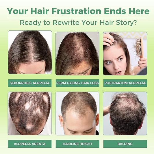 Hair Regrowth Serum,Advanced Hair Regrowth System，Infuse Hair Growth - Nourishing Serum with Biotin,Advanced Treatment for Thicker, Fuller & Stronger Hair,For Men & Women (2+6)