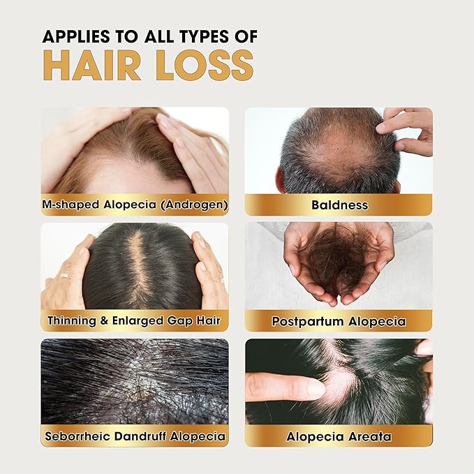 Herb Hair Growth Oil Spray for Women Men - Dry Scalp Hair Growth Serum for Combat Hair Loss, Strengthening, Boost Scalp Health to Stimulate Thinning Hair Regrowth Thicker & Longer