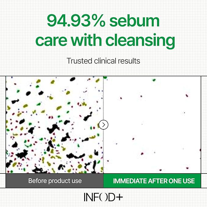 INFODPLUS XCESPI316 Gel Cleanser – Exosome & Walnut Powder Foaming Face Wash for Deep Pore Cleansing, Oil Control & Blackhead Care | Korean Cleanser for Men & Women, 100ml