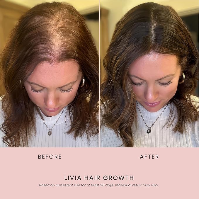 LIVIA Hair Growth Serum – Advanced Hair Strengthening & Regrowth Formula – Reduces Shedding, Hair Loss & Breakage – Nourishes Scalp, Promotes Thicker, Fuller & Healthier Hair– 30ml
