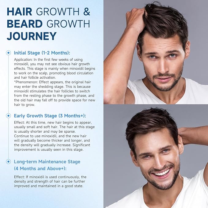 5% Minoxidil for Men and Women Hair Growth, Minoxidil Spray For Beard Growth Serum, Combat Hair Thinning and Loss, Strengthen Regrowth Treatment 3.39 Fl Oz
