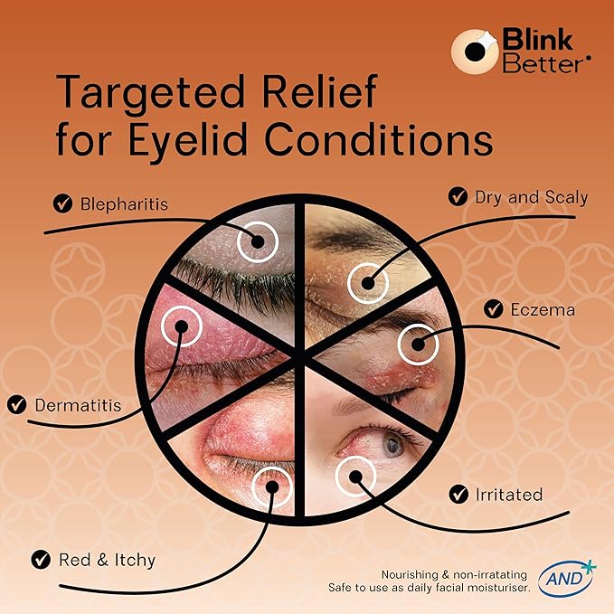 BlinkBetter® Restore Eyelid Cream – 3% Oat Extract & Ceramide Complex – Soothing Hydration & Barrier Support for Dry, Itchy, Red, Sensitive, or Flaky Skin Around the Eyes – All-Day Use – 1oz
