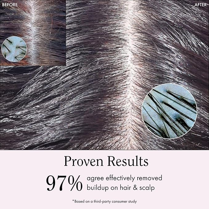 Rizos Curls Travel Apple Cider Vinegar Scalp & Hair Rinse, Clarifies to Remove Product Buildup, Balance Oils, Revive Hair & Scalp, Enhances Softness & Shine, 2.5 oz