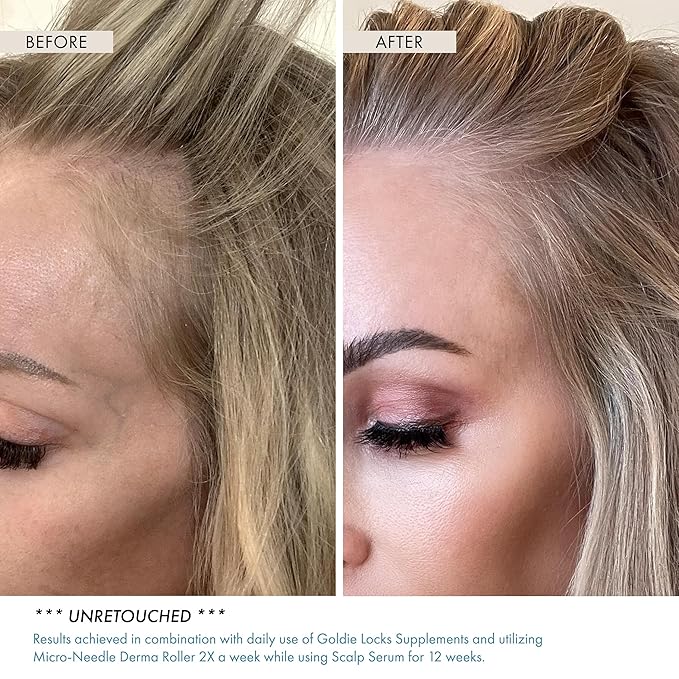 Goldie Locks Scalp Serum - Supports Fuller-Looking Hair and Healthy Scalp - Hydrating Lightweight Formula - Safe for Extensions & Color-Treated Hair - Protein-Free - 1.86 oz