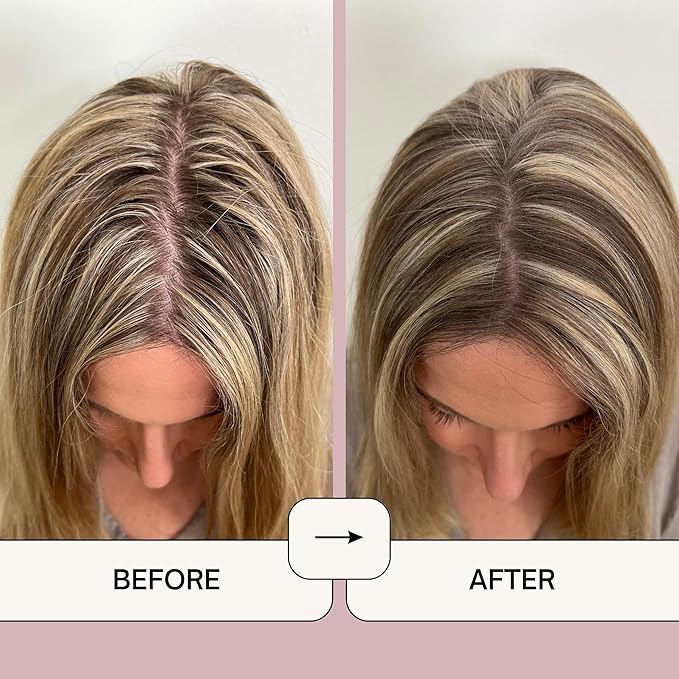 Naturel Volumizing Dry Shampoo Powder for Light Hair | Non-Aerosol | Made in USA | No Benzene, Vegan, Cruelty-Free | Grapefruit Essential Oil | 2.6 OZ Plastic-Free Packaging