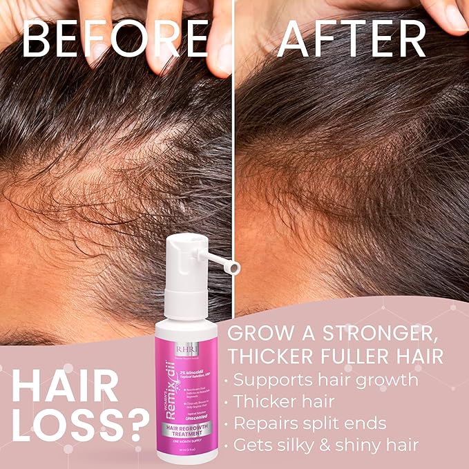 2% Minoxidil for Women Hair Regrowth Spray– Minoxidil Thicker & Fuller Topical Solution for Hair Loss Treatment, Follicle Reactivation, Clinically Proven Formula - 60 ml