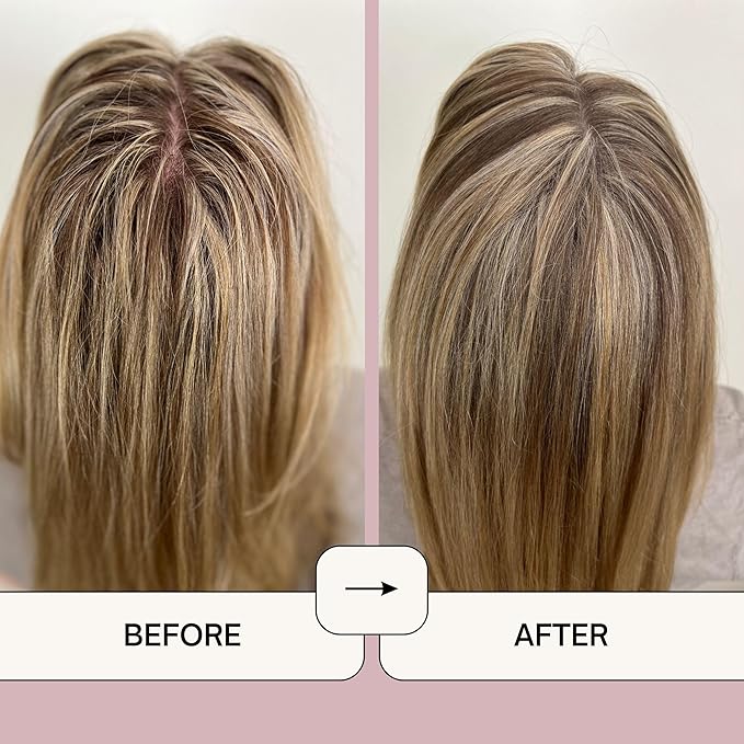 Loxy Dry Shampoo Volumizing Powder for Light, Brown, & Dark Hair | Non Aerosol | Made in USA, No Benzene, Vegan, Talc Free, Aluminum Free | Grapefruit essential oil | 2.6 oz