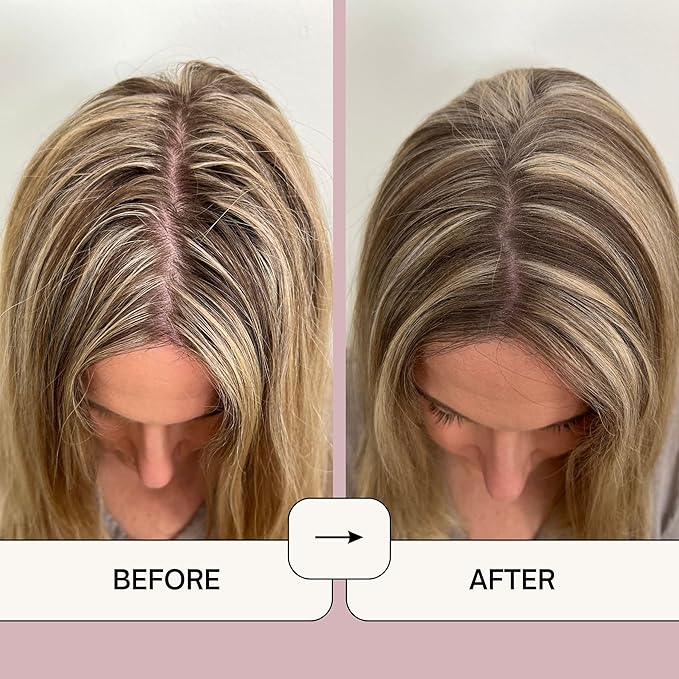 Loxy Dry Shampoo Volumizing Powder for Light, Brown, & Dark Hair | Non Aerosol | Made in USA, No Benzene, Vegan, Talc Free, Aluminum Free | Grapefruit essential oil | 2.6 oz