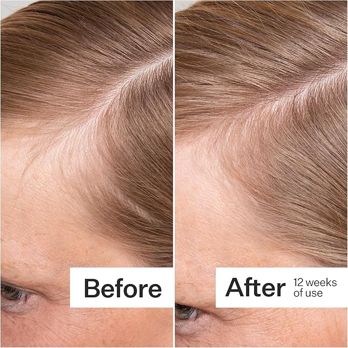 ACT+ ACRE Thick + Full Hair Capsules | Supplement for Thicker, Fuller Looking Hair | Bamboo, Horsetail, Biotin, Vitamin C | Strengthens Roots, Vegan, Gluten-Free, Mint Essenced | 60ct